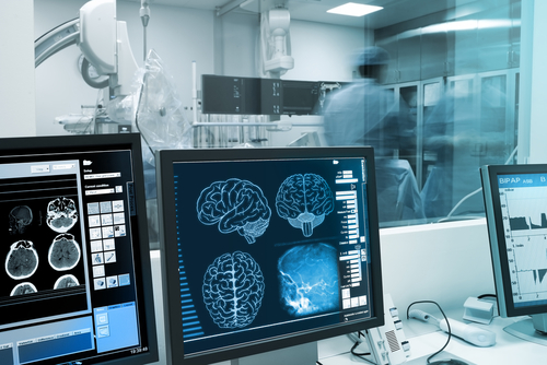 AI set to speed up Parkinson’s diagnosis